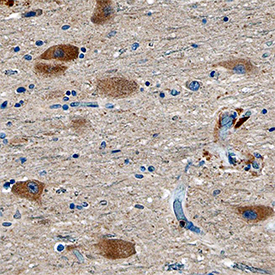 VMAT2 was detected in immersion fixed paraffin-embedded sections of human brain (substantia nigra) using Mouse Anti-Human VMAT2 Monoclonal Antibody (Catalog # MAB8327) at 15 µg/mL overnight at 4 °C. Tissue was stained using the Anti-Mouse HRP-DAB Cell & Tissue Staining Kit (brown; Catalog # CTS002) and counterstained with hematoxylin (blue). Specific staining was localized to neuronal cell bodies. View our protocol for Chromogenic IHC Staining of Paraffin-embedded Tissue Sections.