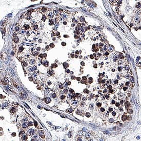 Immunohistochemistry VRK1 Antibody (1F6) [Unconjugated]