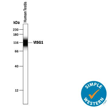 Simple Western lane view shows lysates of human testis tissue, loaded at 0.2 mg/mL. A specific band was detected for VSIG1 at approximately 115 kDa (as indicated) using 10 µg/mL of Sheep Anti-Human VSIG1 Antigen Affinity-purified Polyclonal Antibody (Catalog # AF4818) followed by 1:50 dilution of HRP-conjugated Anti-Sheep IgG Secondary Antibody (Catalog # HAF016). This experiment was conducted under reducing conditions and using the 12-230 kDa separation system.
