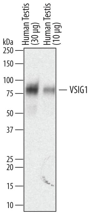 Western blot shows lysates of human testis tissue. PVDF membrane was probed with 0.2 µg/mL of Sheep Anti-Human VSIG1 Antigen Affinity-purified Polyclonal Antibody (Catalog # AF4818) followed by HRP-conjugated Anti-Sheep IgG Secondary Antibody (Catalog # HAF016). A specific band was detected for VSIG1 at approximately 80 kDa (as indicated). This experiment was conducted under reducing conditions and using Immunoblot Buffer Group 1.
