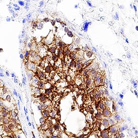 VSIG1 was detected in immersion fixed paraffin-embedded sections of human testis using Rabbit Anti-Human VSIG1 Monoclonal Antibody (Catalog # MAB48181) at 1 µg/mL for 1 hour at room temperature followed by incubation with the Anti-Rabbit IgG VisUCyte™ HRP Polymer Antibody (Catalog # VC003). Before incubation with the primary antibody, tissue was subjected to heat-induced epitope retrieval using Antigen Retrieval Reagent-Basic (Catalog # CTS013). Tissue was stained using DAB (brown) and counterstained with hematoxylin (blue). Specific staining was localized to cell membrane and cytoplasm. View our protocol for IHC Staining with VisUCyte HRP Polymer Detection Reagents.