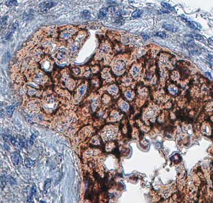VSIG1 was detected in immersion fixed paraffin-embedded sections of human testis using Mouse Anti-Human VSIG1 Monoclonal Antibody (Catalog # MAB48182) at 0.5 µg/mL for 1 hour at room temperature followed by incubation with the Anti-Mouse IgG VisUCyte™ HRP Polymer Antibody (Catalog # VC001). Before incubation with the primary antibody, tissue was subjected to heat-induced epitope retrieval using Antigen Retrieval Reagent-Basic (Catalog # CTS013). Tissue was stained using DAB (brown) and counterstained with hematoxylin (blue). Specific staining was localized to cell membrane in sperm cells. View our protocol for IHC Staining with VisUCyte HRP Polymer Detection Reagents.