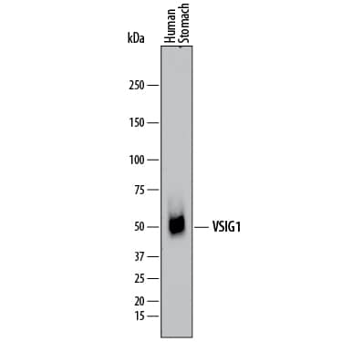Western Blot VSIG1 Antibody (771506) [Unconjugated]