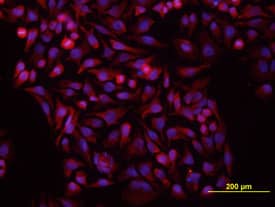 Vang-like Protein 1/VANGL1 was detected in immersion fixed HeLa human cervical epithelial carcinoma cell line using Human Vang-like Protein 1/VANGL1 Monoclonal Antibody (Catalog # MAB5476) at 10 µg/mL for 3 hours at room temperature. Cells were stained using the NorthernLights™ 557-conjugated Anti-Mouse IgG Secondary Antibody (red; Catalog # NL007) and counter-stained with DAPI (blue). View our protocol for Fluorescent ICC Staining of Cells on Coverslips.