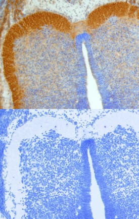 Immunohistochemistry Vang-like Protein 2/VANGL2 Antibody