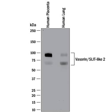 Western blot shows lysates of human placenta tissue and human lung tissue. PVDF membrane was probed with 2 µg/mL of Mouse Anti-Human Vasorin/SLIT-like 2 Monoclonal Antibody (Catalog # MAB2140) followed by HRP-conjugated Anti-Mouse IgG Secondary Antibody (Catalog # HAF018). Specific bands were detected for Vasorin/SLIT-like 2 at approximately 65 and 95 kDa (as indicated). This experiment was conducted under reducing conditions and using Immunoblot Buffer Group 1.