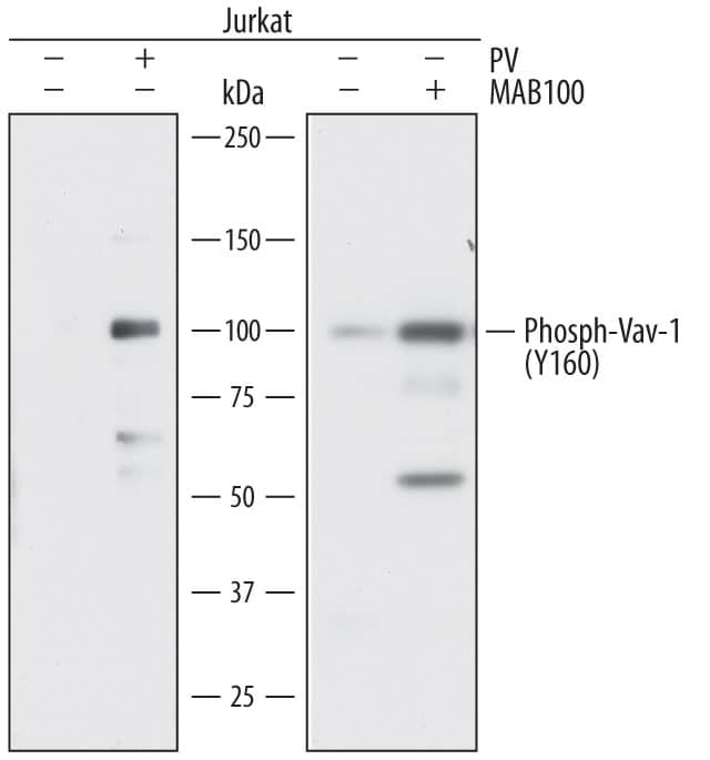 Western Blot Vav-1 [p Tyr160] Antibody (751411) [Unconjugated]