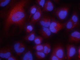 Immunocytochemistry Versican Antibody [Unconjugated] - Isoform V0