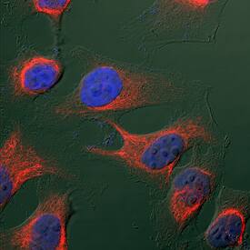 Vimentin was detected in immersion fixed HeLa human cervical epithelial carcinoma cell line using Goat Anti-Human/Mouse/Rat Vimentin Antigen Affinity-purified Polyclonal Antibody (Catalog # AF2105) at 1.7 µg/mL for 3 hours at room temperature. Cells were stained using the NorthernLights™ 557-conjugated Anti-Goat IgG Secondary Antibody (red; Catalog # NL001) and counterstained with DAPI (blue). Specific staining was localized to intermediate filaments in cytoplasm. View our protocol for Fluorescent ICC Staining of Cells on Coverslips.