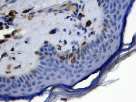Vimentin was detected in immersion fixed paraffin-embedded sections of human skin using 10 &micro;g/mL Goat Anti-Human/Mouse/Rat Vimentin Antigen Affinity-purified Polyclonal Antibody (Catalog # AF2105) overnight at 4 &deg;C. Tissue was stained with the Anti-Goat HRP-DAB Cell & Tissue Staining Kit (brown; Catalog # CTS008) and counterstained with hematoxylin (blue). View our protocol for Chromogenic IHC Staining of Paraffin-embedded Tissue Sections.