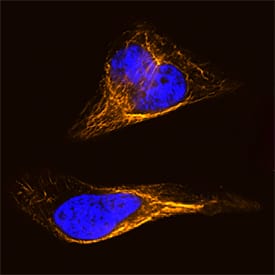 Vimentin was detected in formaldehyde fixed HeLa human cervical epithelial carcinoma cell line using Rat Anti-Human/Mouse/Rat Vimentin Biotinylated Monoclonal Antibody (Catalog # BAM2105) at 8 µg/mL overnight at 4 ° C. Cells were stained using the NorthernLights™ 557-conjugated Streptavidin (orange; Catalog # NL999) and counterstained with DAPI (blue). Specific staining was localized to intermediate filaments. View our protocol for Fluorescent ICC Staining of Cells on Coverslips.