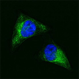 Vimentin was detected in formaldehyde fixed HeLa human cervical epithelial carcinoma cell line using Goat Anti-Human Vimentin Alexa Fluor® 488‑conjugated Antigen Affinity-purified Polyclonal Antibody (green; Catalog # IC8104G) at 1:10 dilution overnight at 4 ° C and counterstained with DAPI (blue). Specific staining was localized to intermediate filaments. View our protocol for Fluorescent ICC Staining of Cells on Coverslips.
