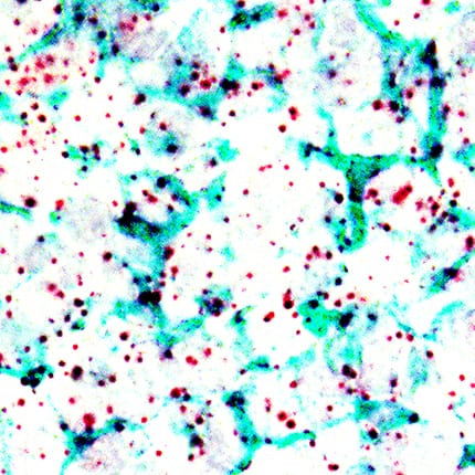 <b>Orthogonal Strategies Validation. </b>Vimentin mRNA (red) and protein (green) was detected in formalin-fixed paraffin-embedded tissue sections of human tonsil probed with ACD RNAScope®Probe (Catalog # 310441) followed by immunohistochemistry using R&D Systems Mouse Anti-Human/Mouse/Rat Vimentin Monoclonal Antibody (Catalog# MAB21052) at 5ug/mL for 1 hour at room temperature followed by incubation with the Anti-Mouse IgG VisUCyte HRP Polymer Antibody (R&D Systems, Catalog # VC001). Tissue was stained using ACD RNAscope®2.5 HD Duplex Detection Reagents (Catalog # 322500).