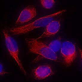 Vimentin was detected in immersion fixed HeLa human cervical epithelial carcinoma cell line using Mouse Anti-Human/Mouse/Rat Vimentin Monoclonal Antibody (Catalog # MAB21052) at 8 µg/mL for 3 hours at room temperature. Cells were stained using the NorthernLights™ 557-conjugated Anti-Mouse IgG Secondary Antibody (red; Catalog # NL007) and counterstained with DAPI (blue). Specific staining was localized to cytoplasm and cytoskeleton. View our protocol for Fluorescent ICC Staining of Cells on Coverslips.