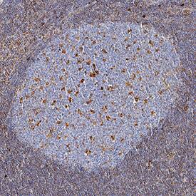 Vimentin was detected in immersion fixed paraffin-embedded sections of human lymph node using Mouse Anti-Human/Mouse/Rat Vimentin Monoclonal Antibody (Catalog # MAB21052) at 5 µg/mL for 1 hour at room temperature followed by incubation with the Anti-Mouse IgG VisUCyte™ HRP Polymer Antibody (Catalog # VC001). Tissue was stained using DAB (brown) and counterstained with hematoxylin (blue). Specific staining was localized to cytoplasm in lymphocytes. View our protocol for IHC Staining with VisUCyte HRP Polymer Detection Reagents.