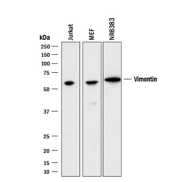 Western blot shows lysates of Jurkat human acute T cell leukemia cell line, MEF mouse embryonic feeder cells, and NR8383 rat alveolar macrophage cell line. PVDF membrane was probed with 2 µg/mL of Mouse Anti-Human/Mouse/Rat Vimentin Monoclonal Antibody (Catalog # MAB21052) followed by HRP-conjugated Anti-Mouse IgG Secondary Antibody (Catalog # HAF018). A specific band was detected for Vimentin at approximately 55 kDa (as indicated). This experiment was conducted under reducing conditions and using Immunoblot Buffer Group 3.