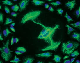 Vimentin was detected in immersion fixed A549 human lung carcinoma cell line using Rat Anti-Human/Mouse/Rat Vimentin Monoclonal Antibody (Catalog # MAB2105) at 10 µg/mL for 3 hours at room temperature. Cells were stained using the NorthernLights™ 493-conjugated Anti-Rat IgG Secondary Antibody (green; Catalog # NL015) and counterstained with DAPI (blue). View our protocol for Fluorescent ICC Staining of Cells on Coverslips.