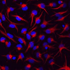 Vimentin was detected in immersion fixed rat cortical stem cells using Rat Anti-Human/Mouse/Rat Vimentin Monoclonal Antibody (Catalog # MAB2105) at 10 µg/mL for 3 hours at room temperature. Cells were stained using the NorthernLights™ 557-conjugated Anti-Rat IgG Secondary Antibody (red; Catalog # NL013) and counterstained with DAPI (blue). Specific staining was localized to cytoskeleton. View our protocol for Fluorescent ICC Staining of Cells on Coverslips.