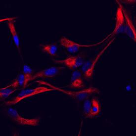 Vimentin was detected in immersion fixed mouse cortical stem cells using Rat Anti-Human/Mouse/Rat Vimentin Monoclonal Antibody (Catalog # MAB2105) at 10 µg/mL for 3 hours at room temperature. Cells were stained using the NorthernLights™ 557-conjugated Anti-Rat IgG Secondary Antibody (red; Catalog # NL013) and counterstained with DAPI (blue). Specific staining was localized to cytoskeleton. View our protocol for Fluorescent ICC Staining of Cells on Coverslips.