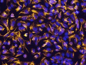 Vimentin was detected in immersion fixed NTera-2 human testicular embryonic carcinoma cell line using Rat Anti-Human/Mouse/Rat Vimentin Monoclonal Antibody (Catalog # MAB2105) at 10 µg/mL for 3 hours at room temperature. Cells were stained using the NorthernLights™ 557-conjugated Anti-Rat IgG Secondary Antibody (yellow; Catalog # NL013) and counterstained with DAPI (blue). View our protocol for Fluorescent ICC Staining of Cells on Coverslips.