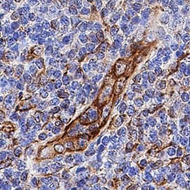Vimentin was detected in immersion fixed paraffin-embedded sections of human tonsil using Rat Anti-Human/Mouse/Rat Vimentin Monoclonal Antibody (Catalog # MAB2105) at 0.5 µg/mL for 1 hour at room temperature followed by incubation with the Anti-Rat IgG VisUCyte™ HRP Polymer Antibody (Catalog # VC005). Tissue was stained using DAB (brown) and counterstained with hematoxylin (blue). Specific staining was localized to cytoplasm. View our protocol for IHC Staining with VisUCyte HRP Polymer Detection Reagents.