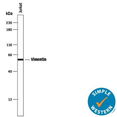 Simple Western lane view shows lysates of Jurkat human acute T cell leukemia cell line, loaded at 0.2 mg/mL. A specific band was detected for Vimentin at approximately 58 kDa (as indicated) using 10 µg/mL of Rat Anti-Human/Mouse/Rat Vimentin Monoclonal Antibody (Catalog # MAB2105) followed by 1:50 dilution of HRP-conjugated Anti-Rat IgG Secondary Antibody (Catalog # HAF005). This experiment was conducted under reducing conditions and using the 12-230 kDa separation system.