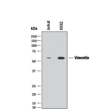 Western blot shows lysates of Jurkat human acute T cell leukemia cell line and K562 human chronic myelogenous leukemia cell line. PVDF membrane was probed with 2 µg/mL of Rat Anti-Human/Mouse/Rat Vimentin Monoclonal Antibody (Catalog # MAB2105) followed by HRP-conjugated Anti-Rat IgG Secondary Antibody (Catalog # HAF005). A specific band was detected for Vimentin at approximately 55 kDa (as indicated). This experiment was conducted under reducing conditions and using Immunoblot Buffer Group 1.
