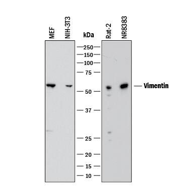 Western blot shows lysates of MEF mouse embryonic feeder cells, NIH-3T3 mouse embryonic fibroblast cell line, Rat-2 rat embryonic fibroblast cell line, and NR8383 rat alveolar macrophage cell line. PVDF membrane was probed with 1 µg/mL of Rat Anti-Human/Mouse/Rat Vimentin Monoclonal Antibody (Catalog # MAB2105) followed by HRP-conjugated Anti-Rat IgG Secondary Antibody (Catalog # HAF005). A specific band was detected for Vimentin at approximately 55 kDa (as indicated). This experiment was conducted under reducing conditions and using Immunoblot Buffer Group 1.
