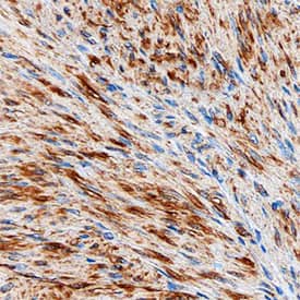 Vinculin was detected in immersion fixed paraffin-embedded sections of human uterus using Sheep Anti-Human/Rat Vinculin Antigen Affinity-purified Polyclonal Antibody (Catalog # AF6896) at 3 µg/mL overnight at 4 °C. Before incubation with the primary antibody, tissue was subjected to heat-induced epitope retrieval using Antigen Retrieval Reagent-Basic (Catalog # CTS013). Tissue was stained using the Anti-Sheep HRP-DAB Cell & Tissue Staining Kit (brown; Catalog # CTS019) and counter-stained with hematoxylin (blue). vView our protocol for Chromogenic IHC Staining of Paraffin-embedded Tissue Sections.