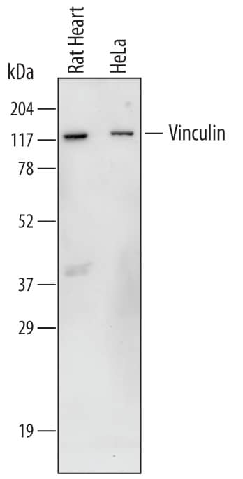 Western blot shows lysates of HeLa human cervical epithelial carcinoma cell line and rat heart tissue. PVDF membrane was probed with 1 µg/mL of Sheep Anti-Human/Rat Vinculin Antigen Affinity-purified Polyclonal Antibody (Catalog # AF6896) followed by HRP-conjugated Anti-Sheep IgG Secondary Antibody (Catalog # HAF016). A specific band was detected for Vinculin at approximately 120 kDa (as indicated). This experiment was conducted under reducing conditions and using Immunoblot Buffer Group 1.