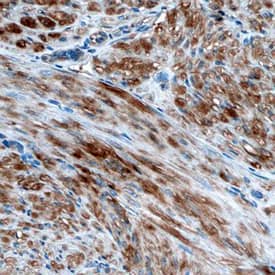 Immunohistochemistry Vinculin Antibody (728526) [Unconjugated]