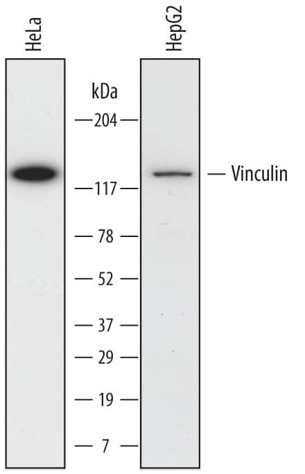 Western Blot Vinculin Antibody (728526) [Unconjugated]