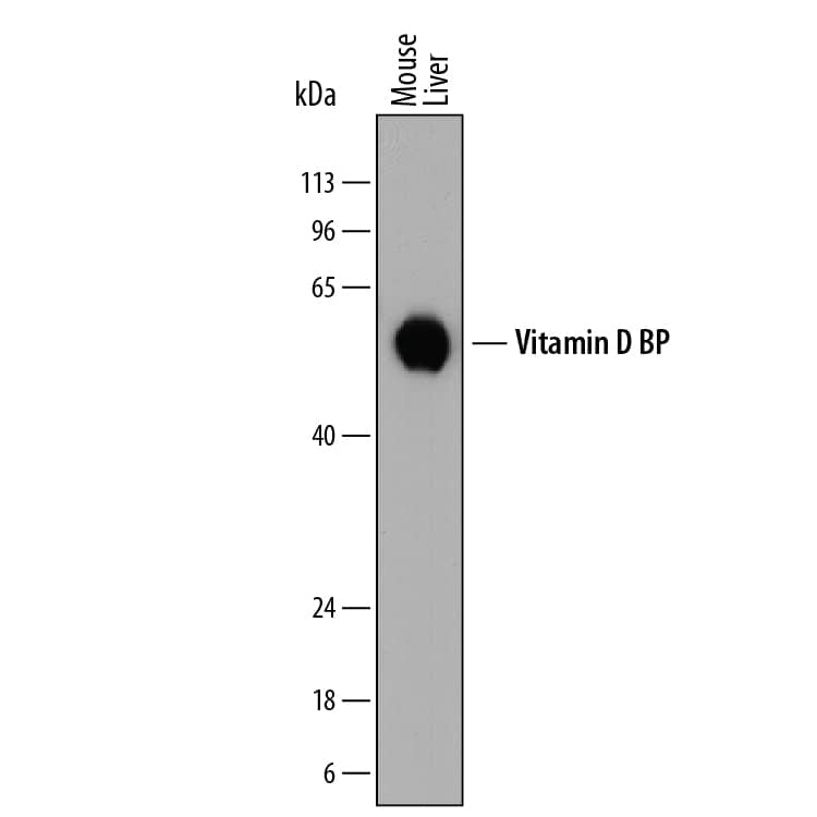 Western Blot Vitamin D BP Antibody [Unconjugated]