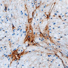 Vitronectin was detected in immersion fixed paraffin-embedded sections of human bladder using Goat Anti-Human Vitronectin Antigen Affinity-purified Polyclonal Antibody (Catalog # AF2349) at 3 µg/mL overnight at 4 °C. Before incubation with the primary antibody, tissue was subjected to heat-induced epitope retrieval using Antigen Retrieval Reagent-Basic (Catalog # CTS013). Tissue was stained using the Anti-Goat HRP-DAB Cell & Tissue Staining Kit (brown; Catalog # CTS008) and counterstained with hematoxylin (blue). Specific staining was localized to extracellular matrix. View our protocol for Chromogenic IHC Staining of Paraffin-embedded Tissue Sections.