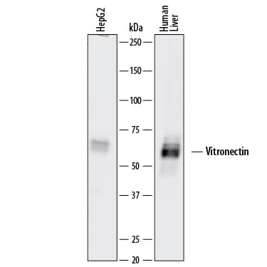 Western blot shows lysates of HepG2 human hepatocellular carcinoma cell line and human liver tissue. PVDF membrane was probed with 1 µg/mL of Goat Anti-Human Vitronectin Antigen Affinity-purified Polyclonal Antibody (Catalog # AF2349) followed by HRP-conjugated Anti-Goat IgG Secondary Antibody (Catalog # HAF017). A specific band was detected for Vitronectin at approximately 65-70 kDa (as indicated). This experiment was conducted under reducing conditions and using Immunoblot Buffer Group 1.
