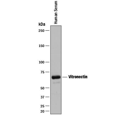 Western Blot Vitronectin Antibody (342603) [Unconjugated]