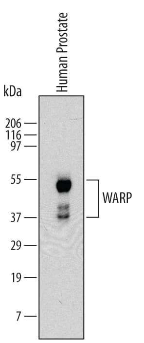 Western blot shows lysates of human prostate tissue. PVDF Membrane was probed with 2 µg/mL of Mouse Anti-Human WARP Monoclonal Antibody (Catalog # MAB6189) followed by HRP-conjugated Anti-Mouse IgG Secondary Antibody (Catalog # HAF007). Specific bands were detected for WARP at approximately 50, 40 and 37 kDa (as indicated). This experiment was conducted under reducing conditions and using Immunoblot Buffer Group 1.