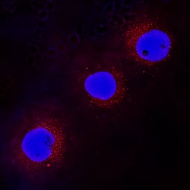 WASP was detected in immersion fixed Jurkat human acute T cell leukemia cell line using Goat Anti-Human/Mouse WASP Antigen Affinity-purified Polyclonal Antibody (Catalog # AF3070) at 15 µg/mL for 3 hours at room temperature. Cells were stained using the NorthernLights™ 557-conjugated Anti-Goat IgG Secondary Antibody (red; Catalog # NL001) and counterstained with DAPI (blue). Specific staining was localized to cytoplasm. View our protocol for Fluorescent ICC Staining of Non-adherent Cells.