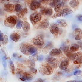 Immunohistochemistry WDR5 Antibody [Unconjugated]