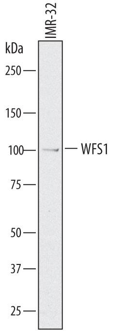 Western blot shows lysates of IMR-32 human neuroblastoma cell line. PVDF membrane was probed with 1 µg/mL of Sheep Anti-Human WFS1 Antigen Affinity-purified Polyclonal Antibody (Catalog # AF7417) followed by HRP-conjugated Anti-Sheep IgG Secondary Antibody (Catalog # HAF016). A specific band was detected for WFS1 at approximately 100 kDa (as indicated). This experiment was conducted under reducing conditions and using Immunoblot Buffer Group 8.