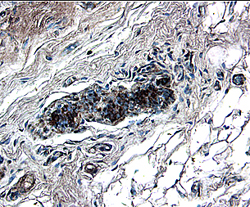 Immunohistochemistry WIF-1 Antibody (133015) [Unconjugated]