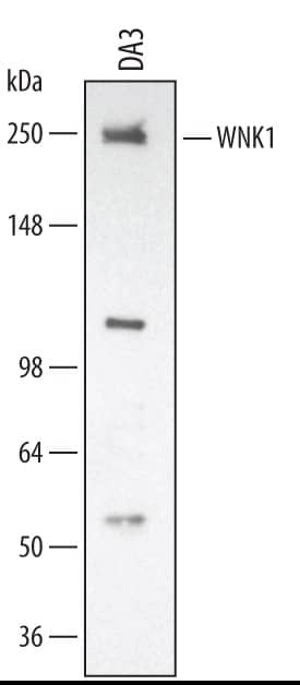 Western Blot WNK1 Antibody [Unconjugated]