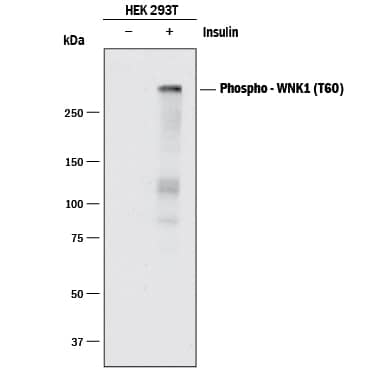 Western Blot WNK1 [p Thr60] Antibody (1259F) [Unconjugated]
