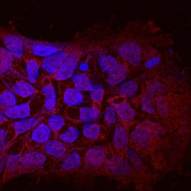 WTX was detected in immersion fixed BG01V human embryonic stem cells using Mouse Anti-Human WTX Monoclonal Antibody (Catalog # MAB7374) at 10 µg/mL for 3 hours at room temperature. Cells were stained using the NorthernLights™ 557-conjugated Anti-Mouse IgG Secondary Antibody (red; Catalog # NL007) and counterstained with DAPI (blue). Specific staining was localized to cytoplasm. View our protocol for Fluorescent ICC Staining of Cells on Coverslips.