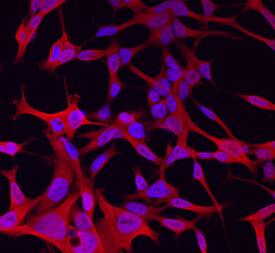 Wnt-11 was detected in immersion fixed LNCaP human prostate cancer cell line using Goat Anti-Mouse Wnt-11 Antigen Affinity-purified Polyclonal Antibody (Catalog # AF2647) at 10 µg/mL for 3 hours at room temperature. Cells were stained using the NorthernLights™ 557-conjugated Anti-Goat IgG Secondary Antibody (red; Catalog # NL001) and counterstained with DAPI (blue). Specific staining was localized to cytoplasm. View our protocol for Fluorescent ICC Staining of Cells on Coverslips.