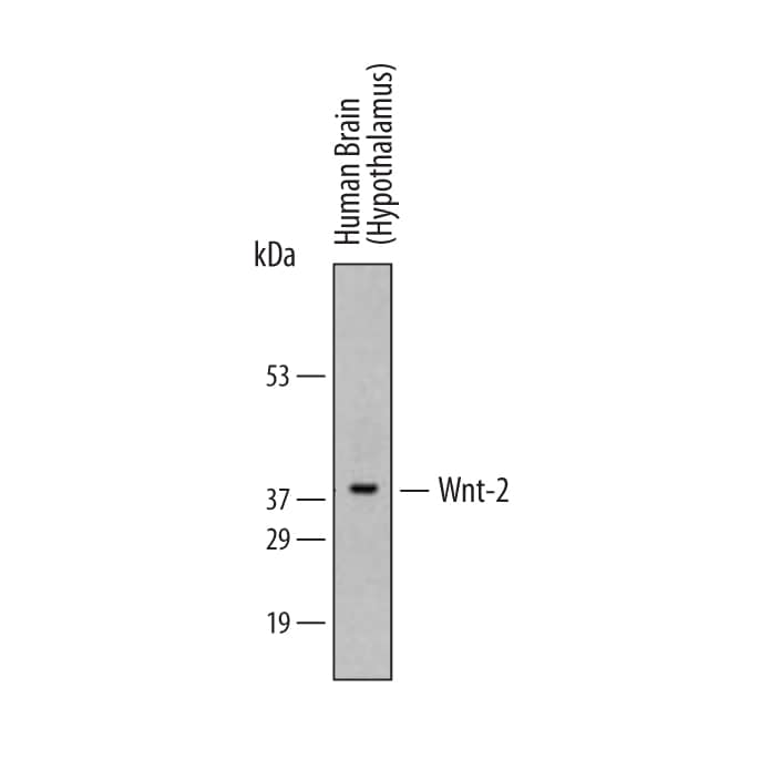 Western Blot Wnt-2 Antibody