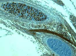 Wnt‑5a was detected in immersion fixed paraffin-embedded sections of mouse embryonic rib using 15 &micro;g/mL Mouse/Rat Wnt‑5a Antigen Affinity-purified Polyclonal Antibody (Catalog # AF645) overnight at 4 &deg;C. Tissue was stained with the Anti-Goat HRP-DAB Cell & Tissue Staining Kit (brown; CTS008) and counterstained with hematoxylin (blue). View our protocol for Chromogenic IHC Staining of Paraffin-embedded Tissue Sections.