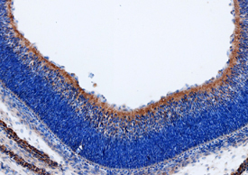 Wnt-9b was detected in imm-ersion fixed frozen sections of mouse embryo (13 d.p.c.) using Goat Anti-Mouse Wnt-9b Antigen Affinity-purified Poly-clonal Antibody (Catalog # AF3669) at 15 µg/mL overnight at 4 °C. Tissue was stained using the Anti-Goat HRP-DAB Cell & Tissue Staining Kit (brown; Catalog # CTS008) and counter-stained with hematoxylin (blue). Specific staining was localized to the retina. View our protocol for Chromogenic IHC Staining of Frozen Tissue Sections.