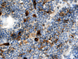 XCL1/Lymphotactin was detected in perfusion fixed frozen sections of mouse thymus using Mouse XCL1/Lymphotactin Biotinylated Antigen Affinity-purified Polyclonal Antibody (Catalog # BAF486) at 15 &micro;g/mL overnight at 4 &deg;C. Tissue was stained using the Anti-Goat HRP-DAB Cell & Tissue Staining Kit (brown; Catalog # CTS008) and counterstained with hematoxylin (blue). View our protocol for Chromogenic IHC Staining of Frozen Tissue Sections.