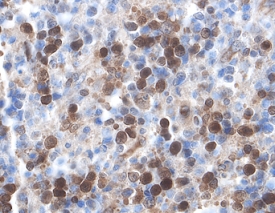 Immunohistochemistry XIAP Antibody [Unconjugated]